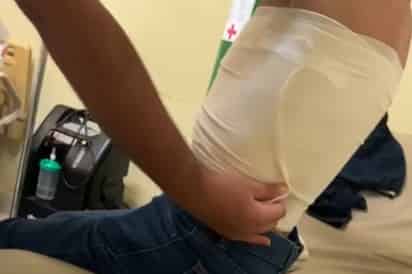 Denuncian a policías por golpear a hombre de 72 años