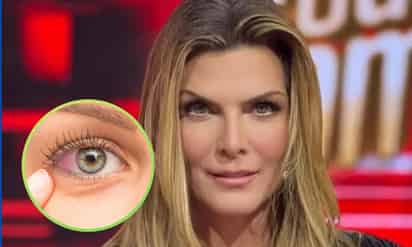¿Qué es un infarto ocular?; la afección que sufrió Montserrat Oliver