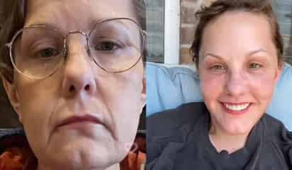 La mujer viral de TikTok que rejuveneció 30 años gracias a una cirujana de Guadalajara