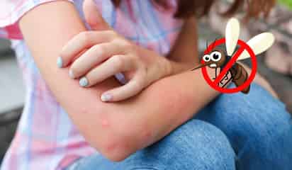 ¿Por qué a unas personas les pican los mosquitos más que a otras?