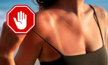 Por qué broncearse es muy peligroso para la salud de la piel