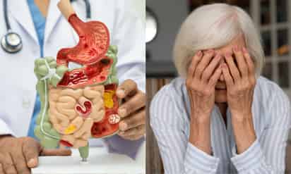 Quienes padecen trastornos intestinales tienen el doble de probabilidad de tener Alzhéimer