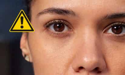 Degeneración macular y edad avanzada