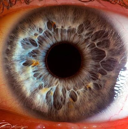 El fotógrafo Suren Manvelyan expuso cómo está compuesta la superficie del iris del ojo, la cual tiene un relieve más complejo del esperado.