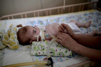 Los pacientes que presentan daño cerebral tienen dificultad para moverse, sin embargo, no necesariamente se afectan sus funciones mentales. (ARCHIVO)