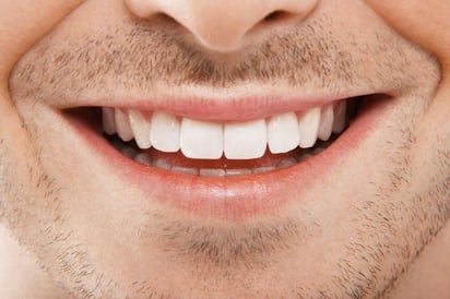 Las carillas pueden suponer el tratamiento estético idóneo para las personas que busquen mejorar la estética de su sonrisa de forma natural, además de contribuir en aumentar de forma muy apreciable su autoestima. (ARCHIVO)