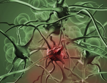 La metástasis consiste en una serie de pasos encadenados donde el tumor primario invade tejidos y acaba esparciéndose por todo el organismo. (ARCHIVO)