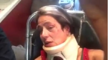 Víctima. América Gabriel fue golpeada por un individuo luego de que le pidiera que levantara los desechos de su perro.