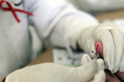 Un total de 36.7 millones de personas en el mundo viven con el virus del VIH, enfermedad que está relacionada con la muerte de 1.1 millones de personas al año. (ARCHIVO)