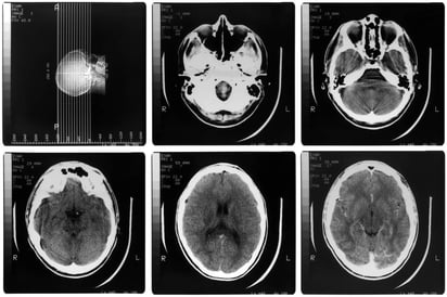 Cuando esto ocurre, el tiempo que pasa antes de llegar al hospital puede hacer la diferencia entre la vida o la muerte, ya que de las 15 millones de personas que mueren cada año en el mundo por esta causa, cinco millones fallecen durante las primeras horas. (ARCHIVO)