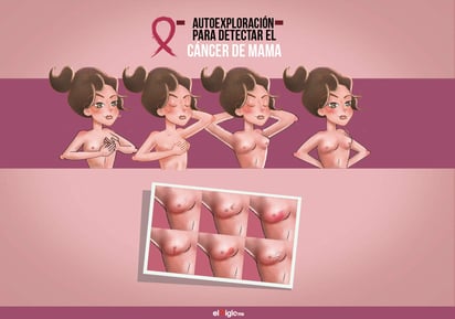 ¿Cómo realizar una autoexploración para detectar cáncer de mama?