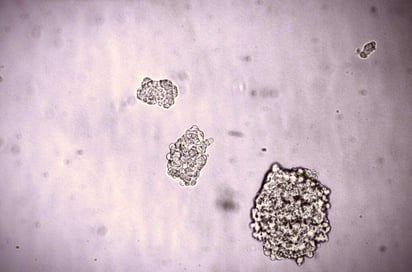 La aplicación de esta técnica, que aumenta la cantidad de la proteína PD-L1, consiguió revertir la hiperglucemia en ratones diabéticos. (ARCHIVO)