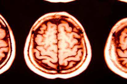 Los científicos pueden 'etiquetar' de una pasada el minúsculo espacio, lleno de líquido, que rodea las células cerebrales, y evitan así tener que marcar individualmente todas las células del área que se quiere analizar. (ARCHIVO)