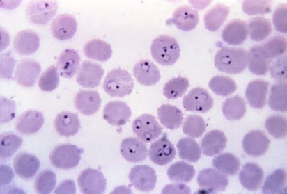 Entamoeba histolytic, amiba que a nivel mundial infecta a 500 millones de personas cada año. (ESPECIAL)