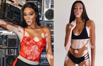 @winnieharlow (INSTAGRAM) 