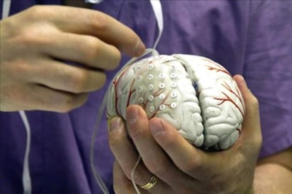 La epilepsia es un enfermedad que ocurre cuando las neuronas del cerebro emiten descargas cuando no les corresponde y eso genera crisis, las cuales se manifiestan, en su mayoría, en convulsiones. (ARCHIVO)