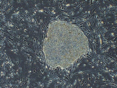 Este tratamiento experimental será el primero de este tipo realizado en el mundo con células iPS, y la quinta aplicación médica en Japón de esta técnica a una enfermedad o lesión concreta. (ARCHIVO)