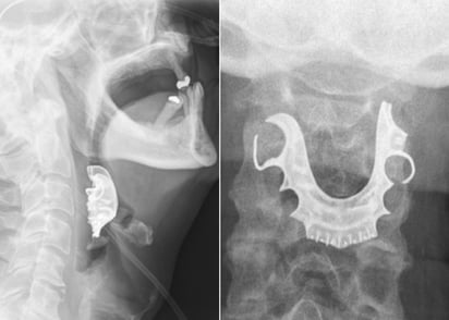 El sujeto tuvo que regresar varias veces al hospital para que detectaran el origen del problema. (INTERNET)