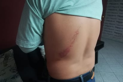 Luego de ser empujado por un guardia de seguridad, Luis cayó sobre los escalones. (EL SIGLO DE TORREÓN)