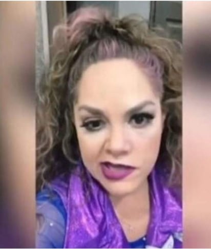 Aspecto. La cara de Tatiana quedó 'chueca' como ella mismo dijo en sus redes, tras sufrir una parálisis facial.