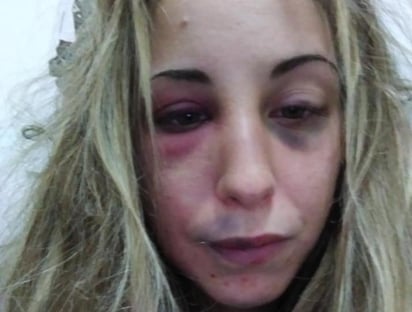 En la publicación la mujer atribuyó los actos violentos a su pareja (INTERNET)   