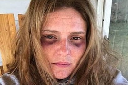 La mujer que fue reportada como desaparecida, habría enviado anteriormente fotografías de su rostro lleno de moretones a otra persona en búsqueda de ayuda (INTERNET) 