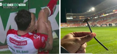 Debido al accidente que le ocurrió a Unai Bilbao, jugador del Necaxa, quien se cortó la rodilla debido a un clavo que sujetaba la lona publicitaria, en el duelo contra el Atlético de San Luis, celebrado ayer viernes en el estadio Victoria, se ha actuado. (ESPECIAL)
