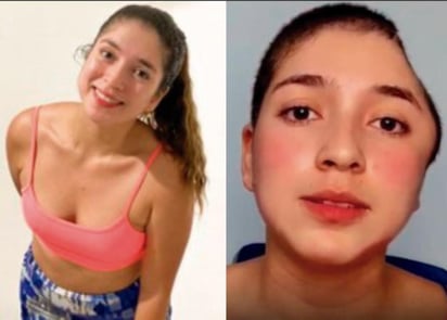 Paula Ágredo, una joven colombiana de 25 años de edad se convirtió en influencer en poco menos de dos semanas luego de compartir su historia tras sufrir un aparatoso accidente en bicicleta. (Especial) 