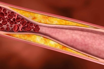 De acuerdo con Medline Plus, el colesterol es una sustancia, parecida a la grasa, que se encuentra en todas las células del cuerpo, la cual es producida por el hígado y se encuentra en algunos alimentos como la carne y determinados productos lácteos. (Especial) 