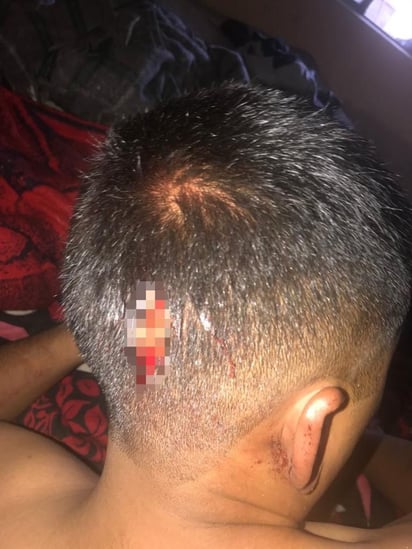 El joven recibió una herida de arma blanca en la parte trasera de la cabeza que requirió sutura. (EL SIGLO DE TORREÓN)