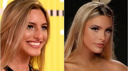 A Lele Pons la cirugía plástica le cambió la vida