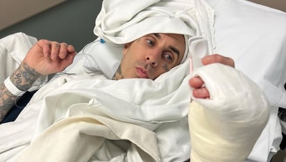 Travis Barker comparte foto de la operación en su dedo