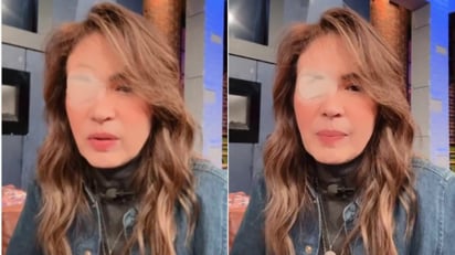 Yolanda Andrade reaparece en redes con un parche en el ojo