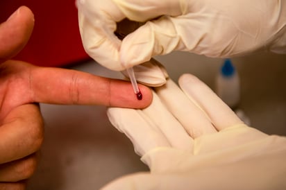 Vinculan consumo de drogas con nuevos casos de VIH