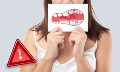 5 hábitos que dañan la salud de tus dientes