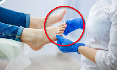 5 problemas comunes en los pies y cómo tratarlos