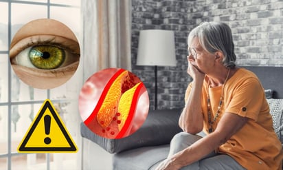 Pérdida de visión y colesterol alto: factores de riesgo para la demencia