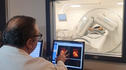 Diariamente se realizan más de 2 mil estudios de radiodiagnóstico en IMSS Coahuila