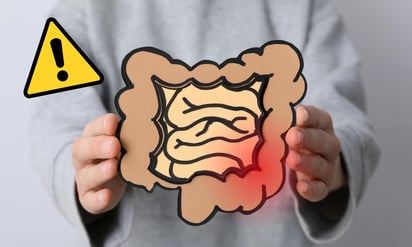 Factores que pueden detonar el síndrome del intestino irritable