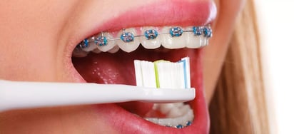 Conserva tu salud dental con los cuidados adecuados. 