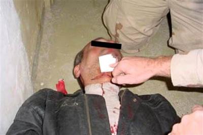 En una foto aparece un hombre con una herida profunda en el cuello, y en otra el mismo hombre está rodeado por otros de camisa y pantalones pardos, uno de los cuales señala la herida con el dedo. 


Las imágenes fueron registradas en Abu Ghraib aproximadamente al mismo tiempo que las fotos de abusos publicadas anteriormente, informó la cadena Special Broadcasting Service.