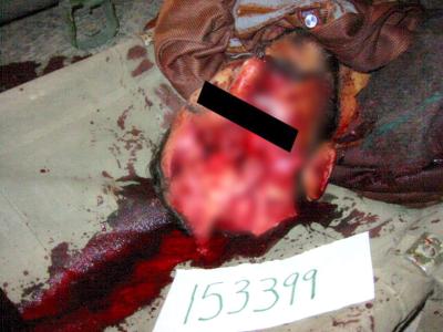 Una red de televisión australiana difundió fotos y vídeos que dijo eran imágenes inéditas de los abusos cometidos contra iraquíes en el 2003 en la prisión de Abu Ghraib, que está bajo el mando estadounidense.