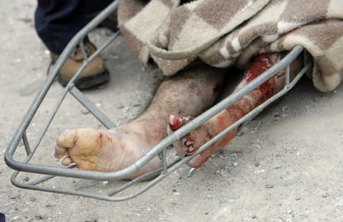 Vista del cuerpo de un hombre que fue encontrado por rescatistas chilenos tras terremoto ocurrido.