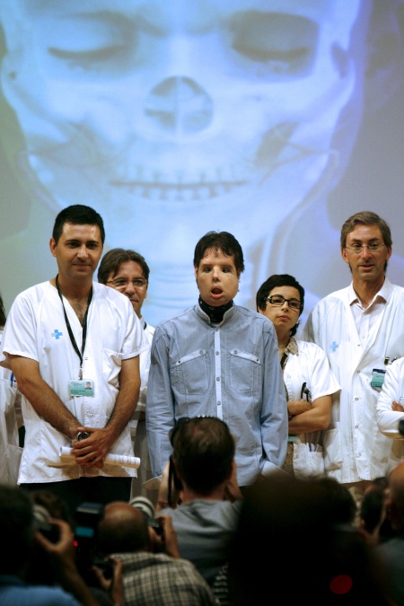 El enfermo expresó su agradecimiento al equipo médico, a la familia del donante y a su propia familia, que le ha apoyado durante años desde que sufrió un accidente que le causó el traumatismo que le deformó la cara.