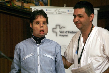 El jefe del Servicio de Cirugía Plástica destacó que Óscar está preparado para volver a casa, aunque durante algunos meses deberá seguir estrictos controles y sesiones de fisioterapia, logopedia y terapia facial hasta que recupere totalmente la movilidad de la cara.