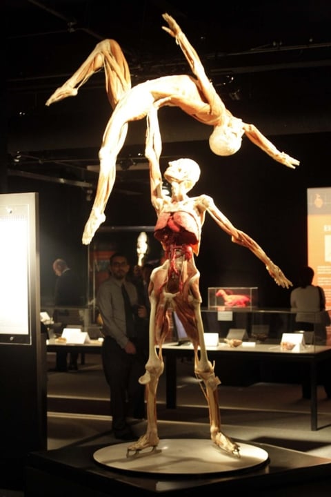 Las partes conservadas se preparan utilizando una técnica llamada plastinación para revelar las estructuras anatómicas internas.