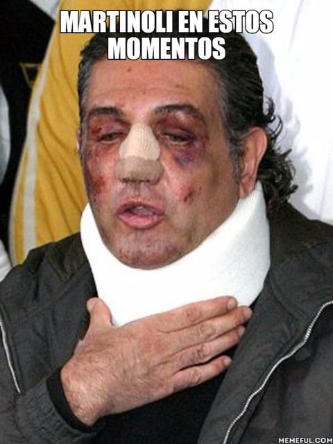 Aseguran que así se ve Martinoli tras la pelea.