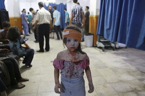 Fotografía de la serie ganadora del segundo premio de la categoría de temas de actualidad de la 59 edición del World Press Photo, tomada por el fotógrafo Abd Doumany. La fotografía muestra a un niña siria que ha sido atendida en un hospital en la ciudad de Douma (Siria) el 22 de agosto de 2015.