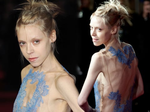 La actriz Antonia Campbell-Hughes quedó anorexica para interpretar a una joven secuestrada en 3096 días. El extremo cambio provocó que la actriz tuviera accidentes como la rotura de un tendón y fractura de una costilla por su dramática pérdida de peso.