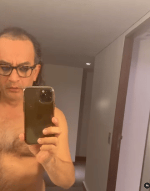Ha compartido todo su proceso de injerto de cabello a través de su cuenta de Instagram con gran emoción.